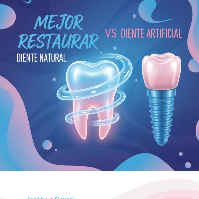 ¿Mejor restaurar el diente natural que colocar un implante?