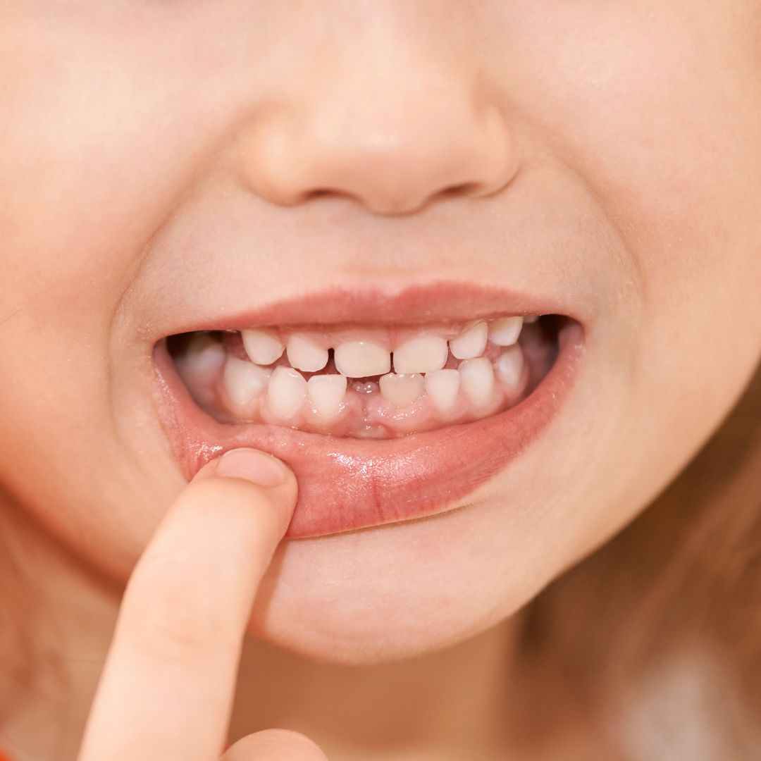 Dentista infantil Torrevieja