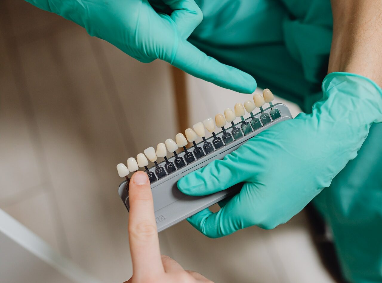 Tratamientos estética dental